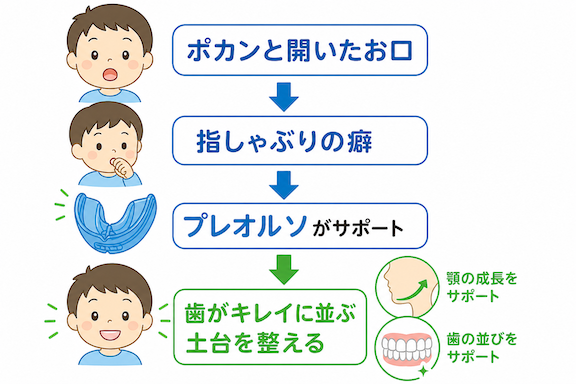 プレオルソとは?マウスピース矯正の基本