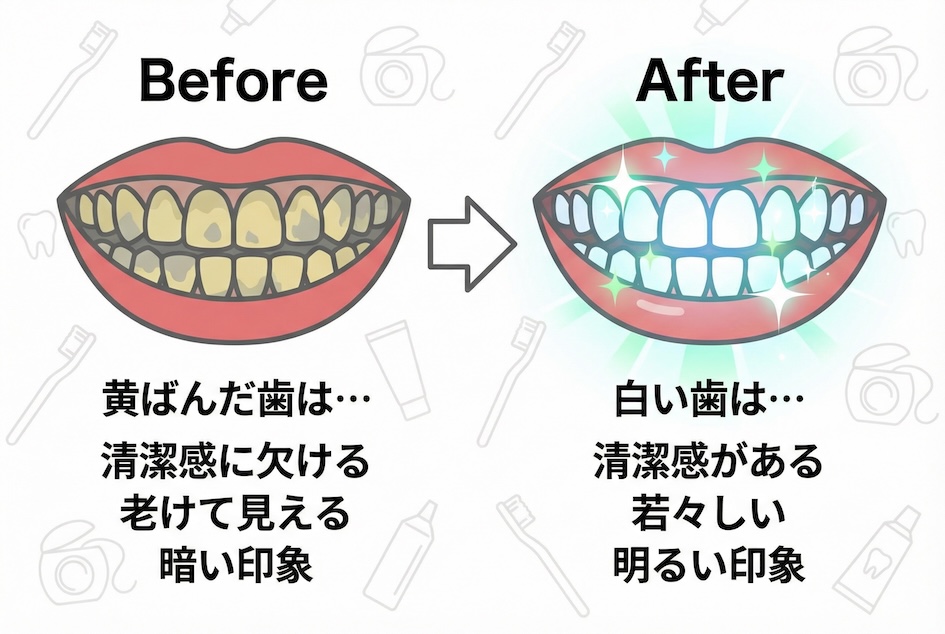 こんなはずじゃなかった…ホワイトニングのよくある失敗例と回避策