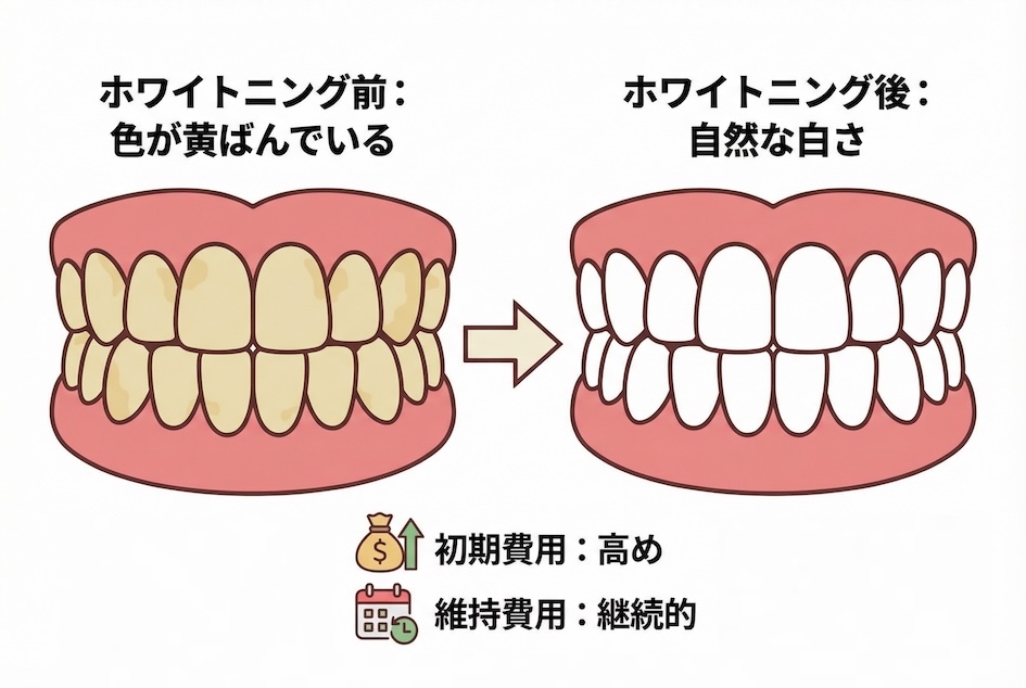 歯科医師が本音で語るホワイトニングの限界と可能性