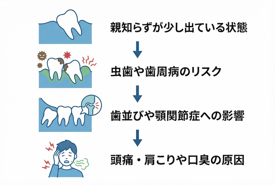 親知らずが少し出てる場合は放置して大丈夫？注意点を解説