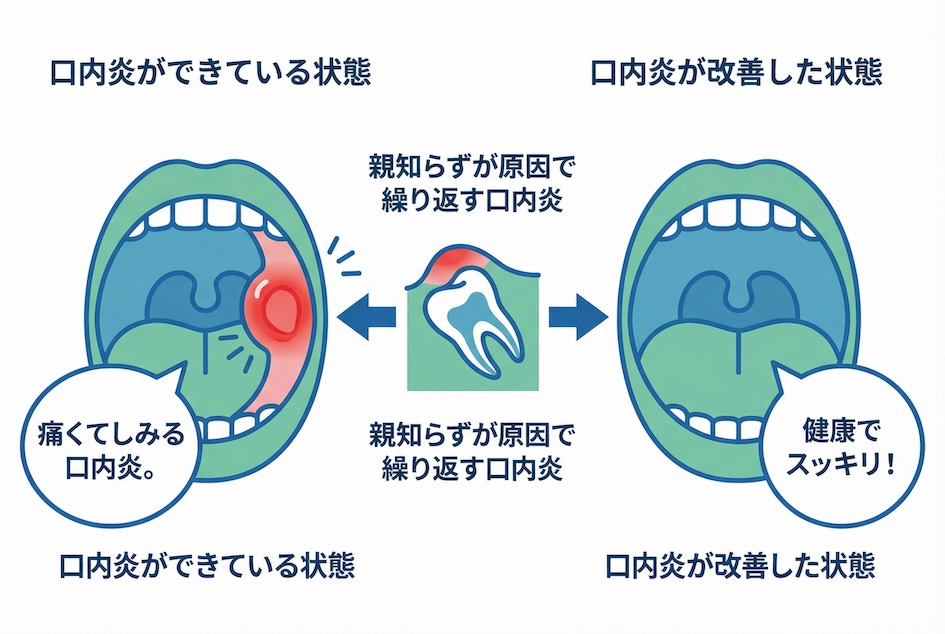 今すぐできる応急処置と歯科医院を受診するタイミング