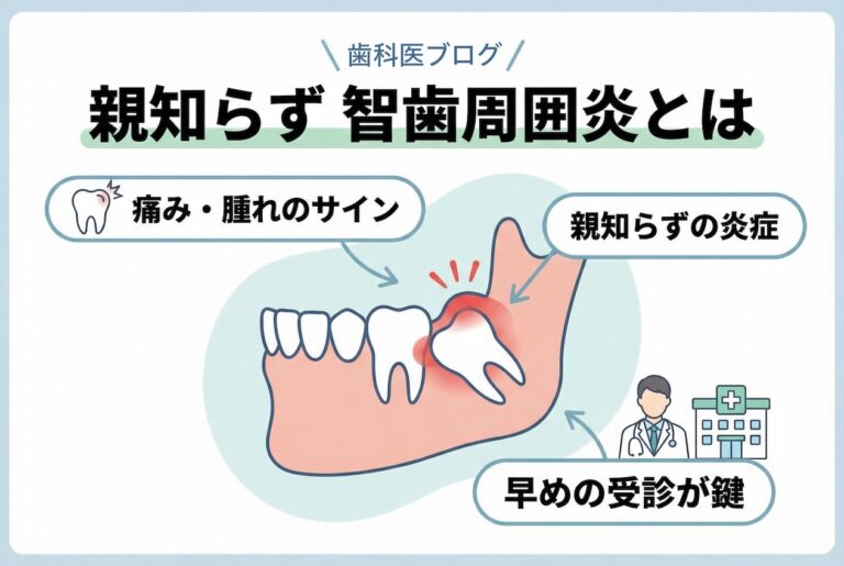親知らず 智歯周囲炎とは