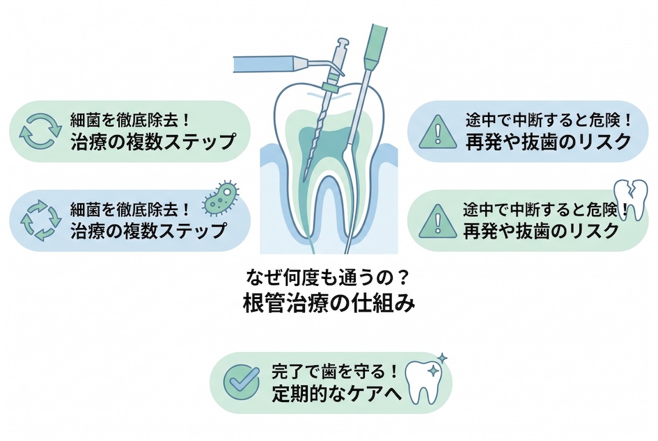 なぜ何度も通うの？根幹治療の内容と、通院を中断してはいけない理由
