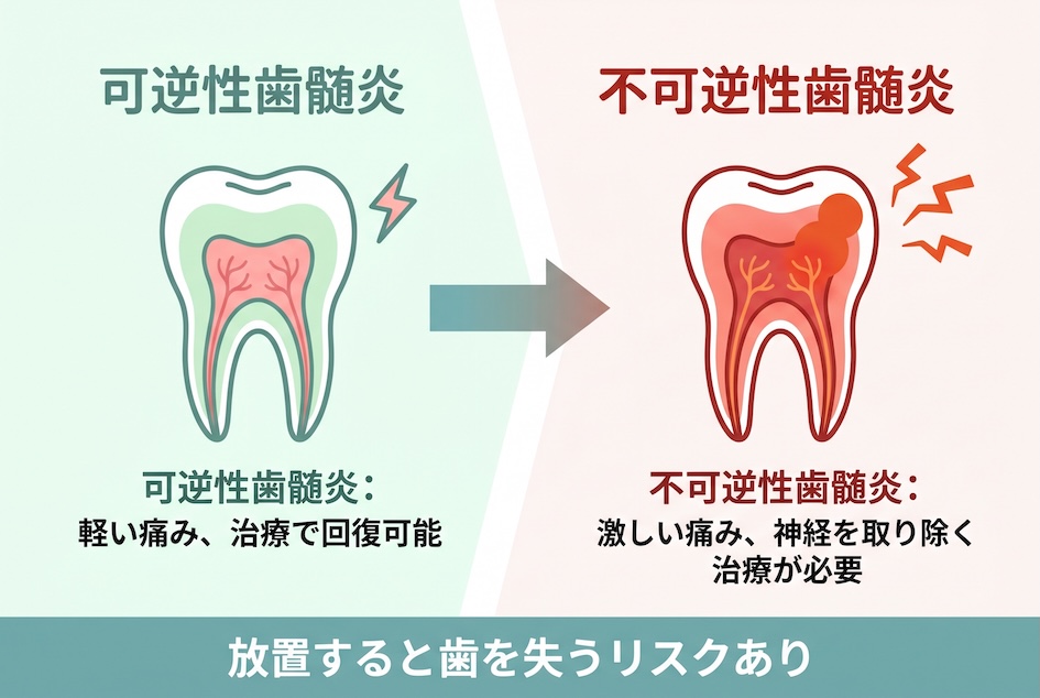 歯の神経を救う「根管治療」とはどんな治療か