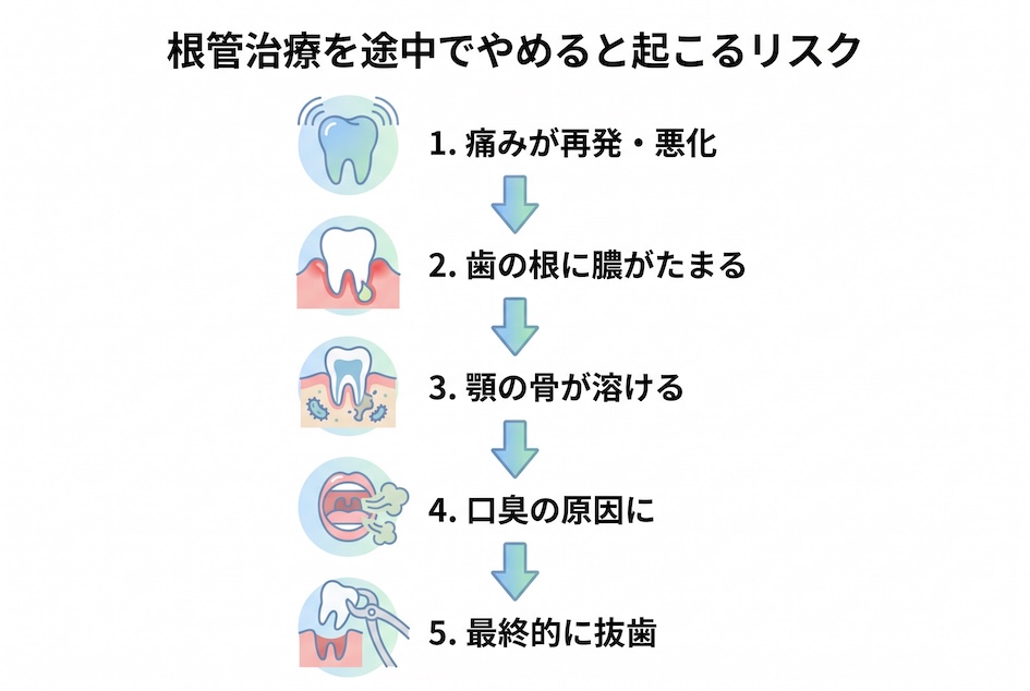 根管治療を途中でやめる（放置する）と起こる5つのリスク