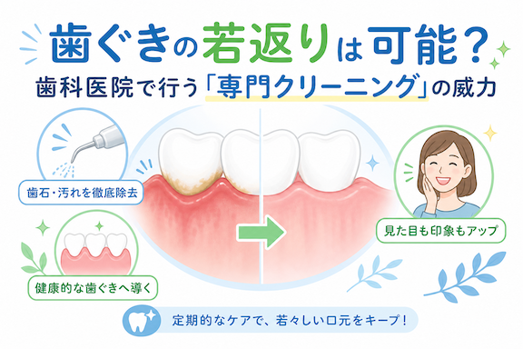 歯ぐきの若返りは可能?歯科医院で行う「専門クリーニング」の威力