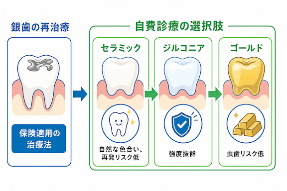 もう痛い思いをしないために。銀歯以外の詰め物・被せ物の選択肢