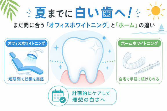 夏までに白い歯へ!まだ間に合う「オフィスホワイトニング」と「ホーム」の違い