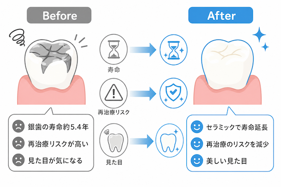 歯医者がセラミックを勧める本当の理由