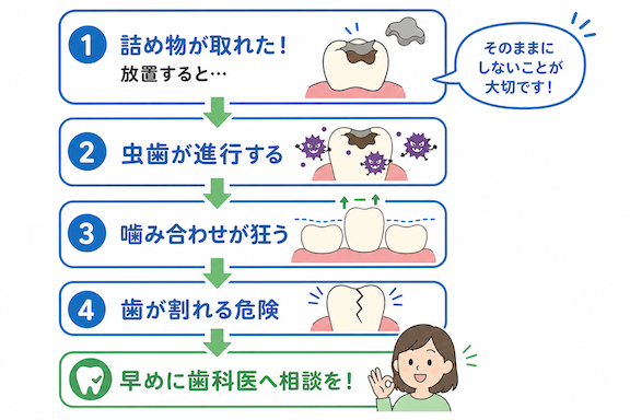 自分で戻す?市販の接着剤は?よくある疑問に歯科医が断言